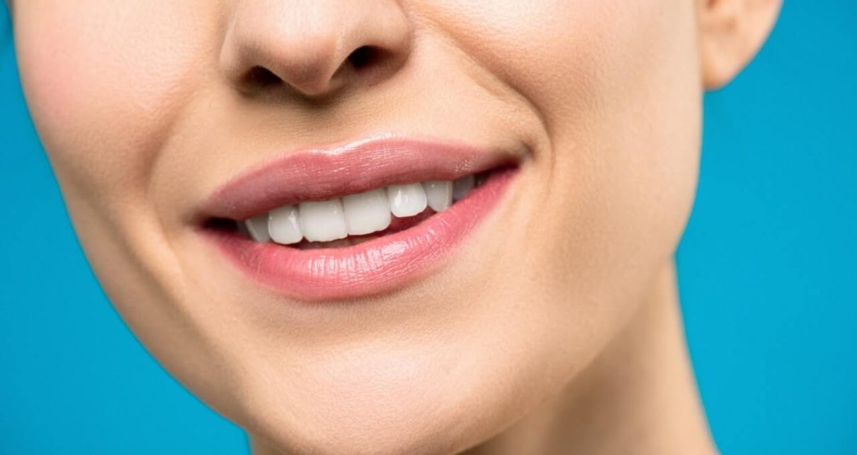 Ligaturowanie zębów – co to jest?
